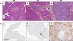 CD3e Antibody in Immunohistochemistry (Paraffin) (IHC (P))