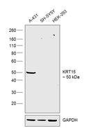 Cytokeratin 15 Antibody in Western Blot (WB)