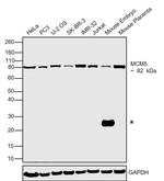 MCM5 Antibody in Western Blot (WB)