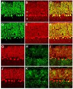 PMCA4 ATPase Antibody in Immunocytochemistry, Immunohistochemistry (ICC/IF, IHC)