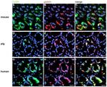 Calcium Sensing Receptor Antibody in Immunohistochemistry (IHC)