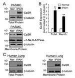 Calcium Sensing Receptor Antibody in Western Blot (WB)