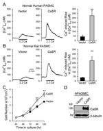 Calcium Sensing Receptor Antibody in Western Blot (WB)