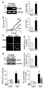 Calcium Sensing Receptor Antibody in Western Blot, Immunocytochemistry (WB, ICC/IF)