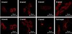 Calcium Sensing Receptor Antibody in Immunocytochemistry (ICC/IF)