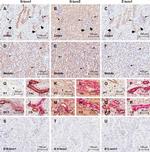 Calcium Sensing Receptor Antibody in Immunohistochemistry (IHC)