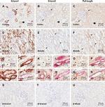 Calcium Sensing Receptor Antibody in Immunohistochemistry (IHC)