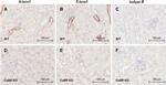 Calcium Sensing Receptor Antibody in Immunohistochemistry (IHC)