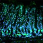 Calcium Sensing Receptor Antibody in Immunohistochemistry (Frozen) (IHC (F))