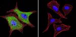 VCP Antibody in Immunocytochemistry (ICC/IF)