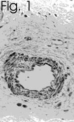 Endothelin 1 Antibody in Immunohistochemistry (IHC)