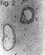 Endothelin 1 Antibody in Immunohistochemistry (IHC)