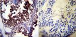 HSP70 Antibody in Immunohistochemistry (Paraffin) (IHC (P))