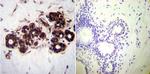 HSP70 Antibody in Immunohistochemistry (Paraffin) (IHC (P))