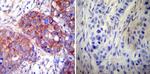 HSP60 Antibody in Immunohistochemistry (Paraffin) (IHC (P))