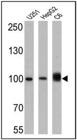 Importin beta-1 Antibody in Western Blot (WB)