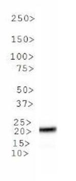 MGMT Antibody in Western Blot (WB)