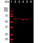 alpha Internexin Antibody in Western Blot (WB)