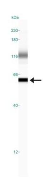 alpha Internexin Antibody in Western Blot (WB)