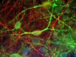 alpha Internexin Antibody in Immunocytochemistry (ICC/IF)