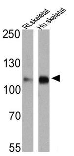 SERCA2 ATPase Antibody in Western Blot (WB)