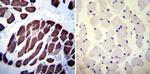 SERCA1 ATPase Antibody in Immunohistochemistry (Paraffin) (IHC (P))