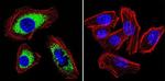 SERCA2 ATPase Antibody in Immunocytochemistry (ICC/IF)