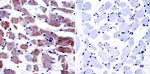 CaV1.1 Antibody in Immunohistochemistry (Paraffin) (IHC (P))