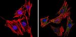 Phospholamban Antibody in Immunocytochemistry (ICC/IF)