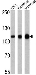 ATP1A1 Antibody in Western Blot (WB)