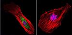 Mu-Calpain Antibody in Immunocytochemistry (ICC/IF)