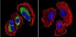 Mu-Calpain Antibody in Immunocytochemistry (ICC/IF)