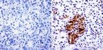 PARP1 Antibody in Immunohistochemistry (Paraffin) (IHC (P))