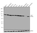 VCP Antibody in Western Blot (WB)