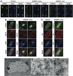 HSP70 Antibody in Immunohistochemistry (IHC)