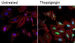 NFATC2 Antibody in Immunocytochemistry (ICC/IF)