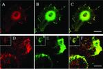 Acetylcholinesterase Antibody in Immunocytochemistry (ICC/IF)