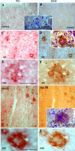 Acetylcholinesterase Antibody in Immunohistochemistry (IHC)