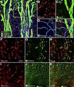 CD31 Antibody in Immunohistochemistry (IHC)