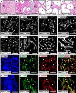 CD31 Antibody in Immunohistochemistry (Frozen) (IHC (F))