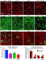 CD31 Antibody in Immunohistochemistry (IHC)