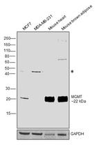 MGMT Antibody in Western Blot (WB)