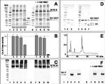 SERCA1 ATPase Antibody in Western Blot (WB)