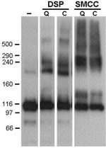 SERCA1 ATPase Antibody in Western Blot (WB)