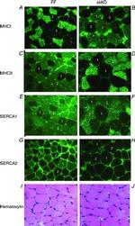 SERCA1 ATPase Antibody in Immunocytochemistry (ICC/IF)