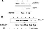 SERCA1 ATPase Antibody in Western Blot (WB)