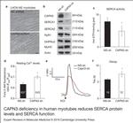 SERCA1 ATPase Antibody in Western Blot (WB)