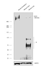 Ryanodine Receptor Antibody