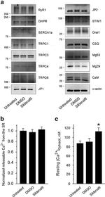 SERCA1 ATPase Antibody in Western Blot (WB)