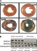 SERCA2 ATPase Antibody in Western Blot (WB)